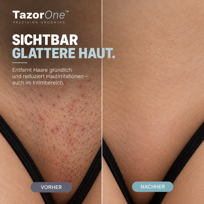 TazorOne™ – Der Rasierer, der nicht stumpf wird